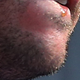 Illustration for article titled Whose Disgusting Baseball Chin Is This?